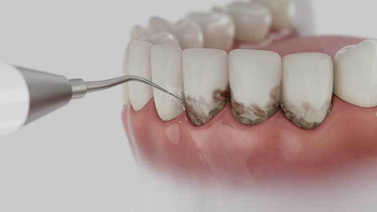 Reliable Wisdom Tooth Removal contractor in Schoolcraft County County, MI by Dentist Open Now